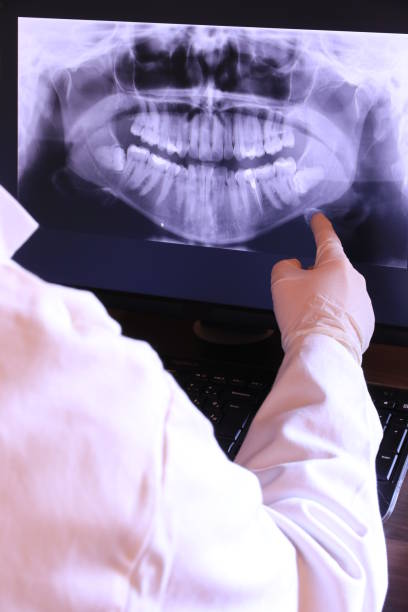 Best Emergency Dental Care for Broken or Chipped Teeth in Mescal, AZ